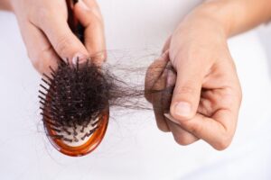 Tips to Prevent Hair Loss